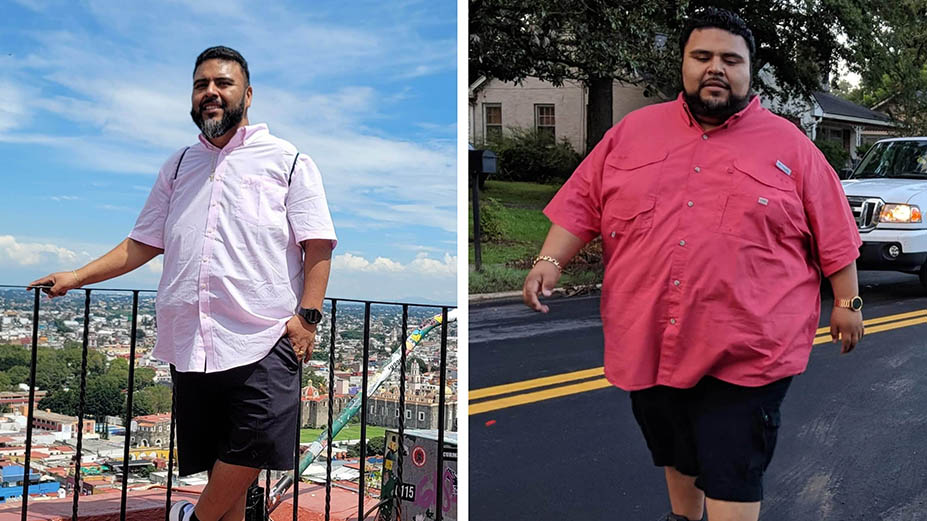 Bariatric Surgery Helps Rome Man Become More Active